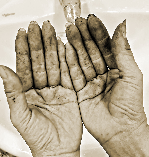 Bàn tay của chị Nguyễn Thị Thu Hường sau quãng thời gian làm việc nấu nướng…